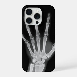 Coque iPhone 15 Pro Housse Skeleton pour iPhone 15 pro