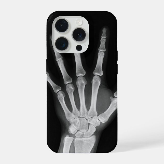 Coque iPhone Housse Skeleton pour iPhone 15 pro (Verso)