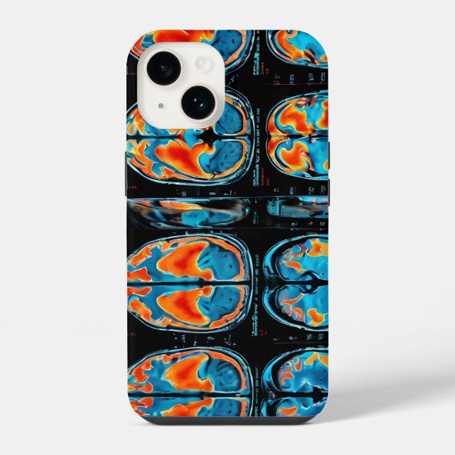 Coque iPhone IRM cérébrale (Verso)