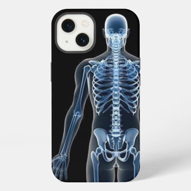 Coque iPhone Radiographie de Jean Doe (Verso)