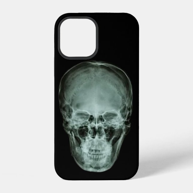 Coque iPhone Radiographie du crâne (Verso)