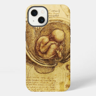 Etui iPhone 13 Vue d'un fœtus dans l'utérus, Ob-Gyn Médical