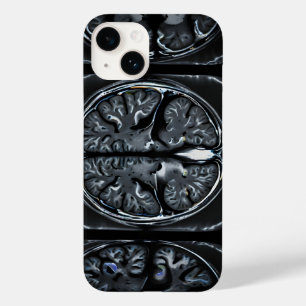 Coque Case-Mate iPhone Analyse cérébrale par IRM