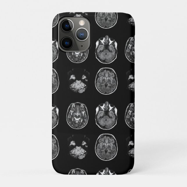 Coques Case-Mate iPhone Analyse IRM du cerveau (Dos)