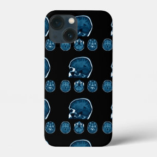 Case-Mate iPhone Case Analyse Mri du cerveau