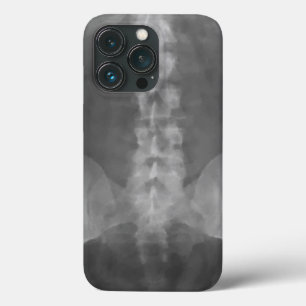 Coque Case-Mate iPhone Art numérique X-Ray