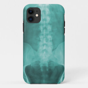 Case-Mate iPhone Case Cas de l'iPhone 5 d'art de rayon X de Digitals