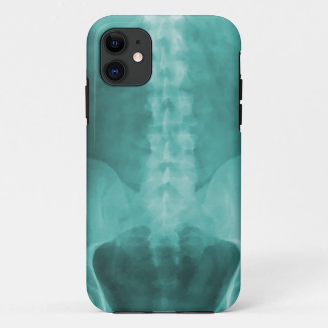 Coques Case-Mate iPhone Cas de l'iPhone 5 d'art de rayon X de Digitals (Dos)