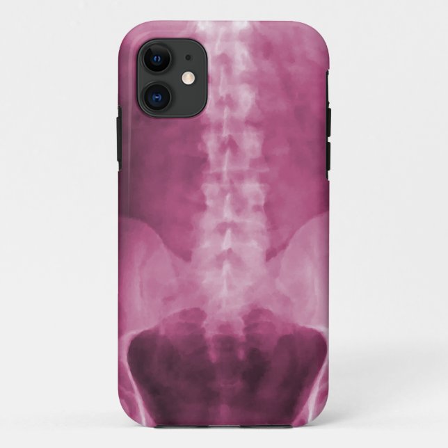 Coques Case-Mate iPhone Cas de l'iPhone 5 d'art de rayon X de Digitals (Dos)
