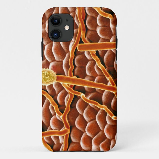 Coques Case-Mate iPhone Champignon de rouille pulvérulente sur la (Dos)