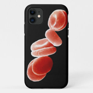 Case-Mate iPhone Case Globules rouges