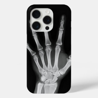 Coque Case-Mate iPhone Housse Skeleton iPhone 15 pro