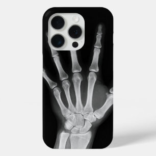 Coque Case-Mate iPhone Housse Skeleton pour iPhone 15 pro