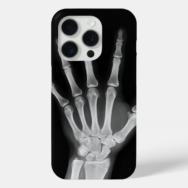 Coques Case-Mate iPhone Housse Skeleton pour iPhone 15 pro (Verso)