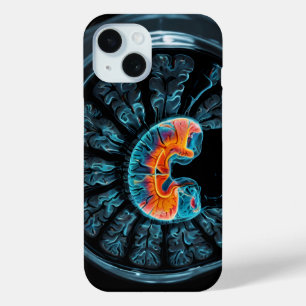 Coque Case-Mate iPhone IRM cérébrale