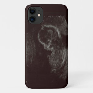 Case-Mate iPhone Case Photo de votre bébé Ultrasound