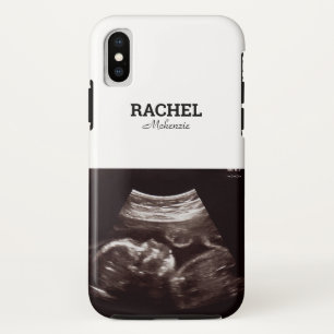Case-Mate iPhone Case Photo Ultrasonic Monogramme noir et blanc