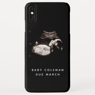 Case-Mate iPhone Case Pregnancy Baby Sonogramme Ultrasound Photo