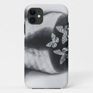 Coque Case-Mate iPhone Rayon X des papillons dans l'estomac