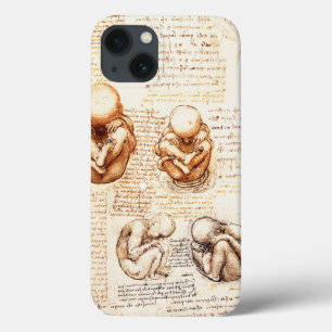 Etui iPhone 13 Vues d'un foetus dans l'utérus, Ob-Gyn Médicale
