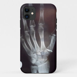 Coque Case-Mate iPhone X cas de téléphone de main de rayon