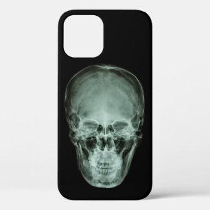 Case-Mate iPhone Case X-Ray crâne