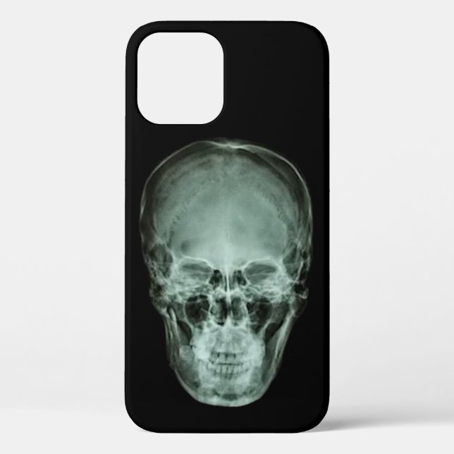Coques Case-Mate iPhone X-Ray crâne (Verso)
