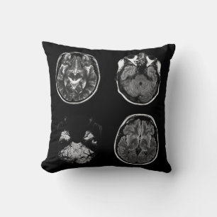 Coussin Analyse IRM du cerveau