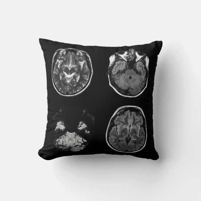 Coussin Analyse IRM du cerveau (Recto)