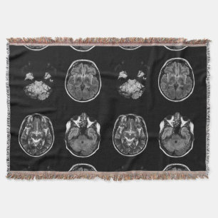 Couverture Analyse IRM du cerveau
