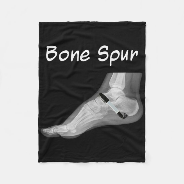 Couverture Polaire Trump Bone Spur Ink Pen Funny Anti Trump  (Devant)