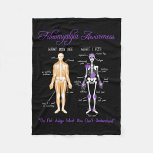 Couverture Polaire Vous Voyez Ce Que Je Ressens Squelette Fibromyalgi