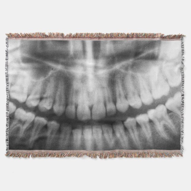 Couverture X-Ray Teeth Bouche sourire noir et blanc (Devant)