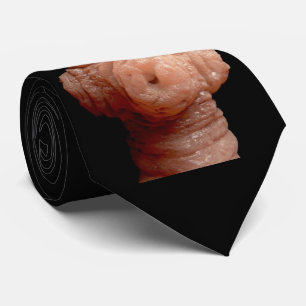 Cravate - ténia d'erinaceieuropaei de Spirometra