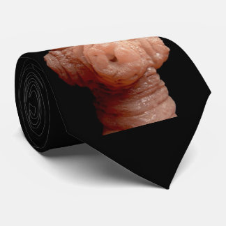 Cravate - ténia d'erinaceieuropaei de Spirometra