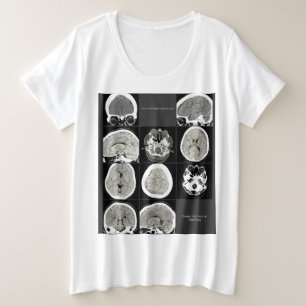 CTScan_