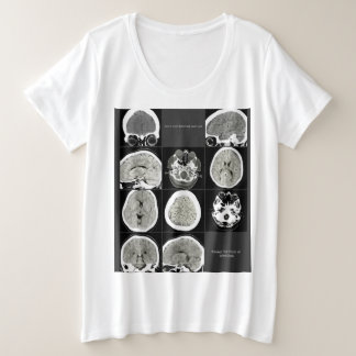 CTScan_