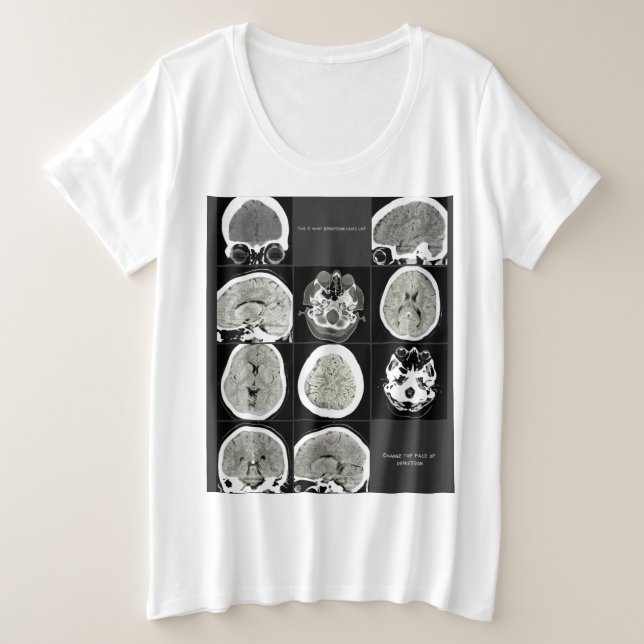 CTScan_ (Design devant)