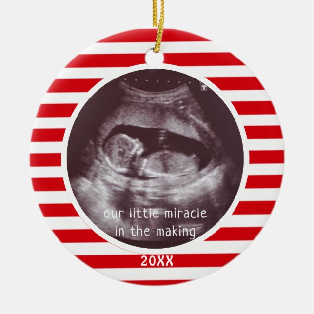 Décoration En Céramique Bébé Ultrasound Photo Rouge Blanc rayure Noël (Devant)