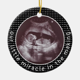 Décoration En Céramique Petit Miracle Pour Faire Du Sonogramme Photo Ultra