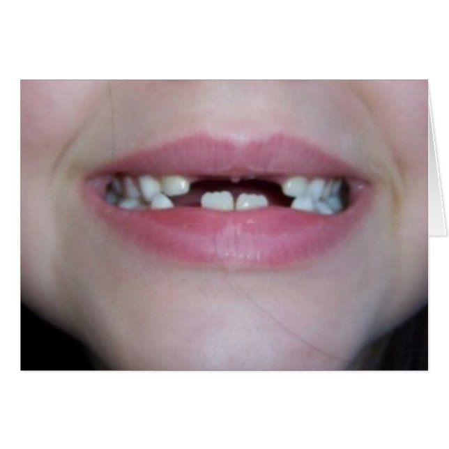 dents (Devant horizontal)