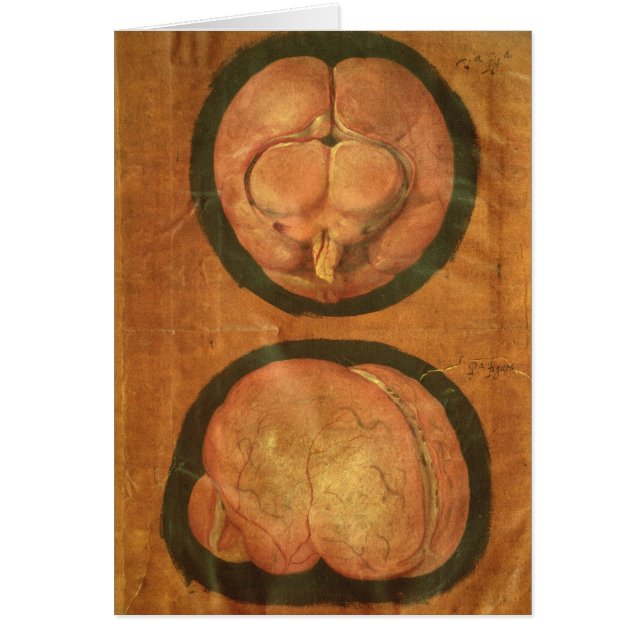 Dessin anatomique de l'esprit humain (Devant)