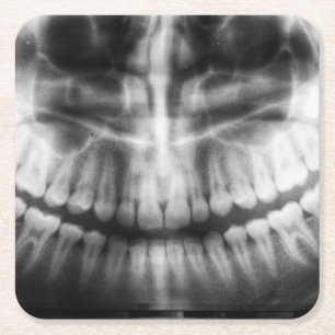 Dessous-de-verre Carré En Papier X-Ray Teeth Bouche sourire noir et blanc