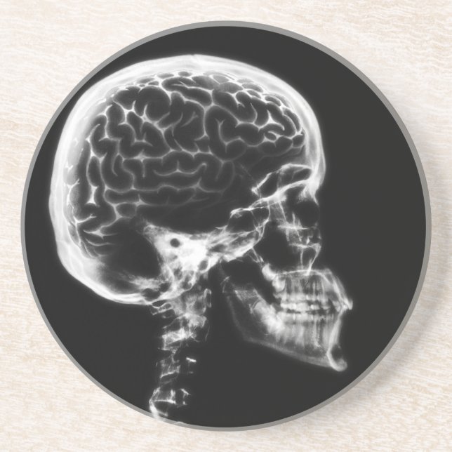 DESSOUS DE VERRE EN GRÈS CERVEAU-CIEL X-RAY - NOIR ET BLANC (Devant)