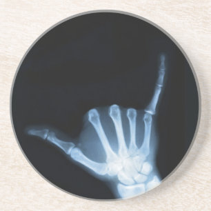 Dessous De Verre En Grès SYMBOLE Shaka X-Ray (Perdre la main)