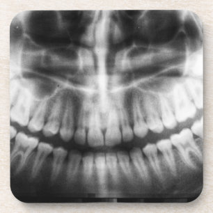 Dessous-de-verre X-Ray Teeth Bouche sourire noir et blanc