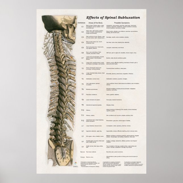 Effects of Spinal Subluxation Poster Chiropractic (Devant)