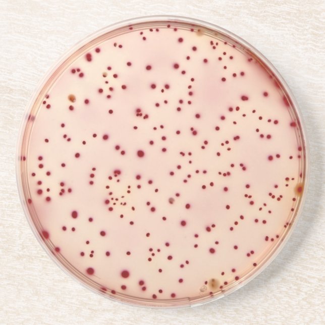 En Grès Dessous de verre de boîte de Pétri (Devant)