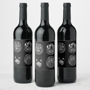 Étiquette Pour Bouteilles De Vin Analyse IRM du cerveau