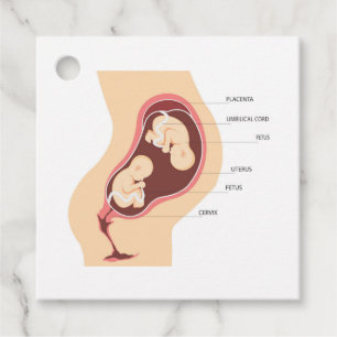 Étiquettes Cadeau Grossesse jumelle dizygotique